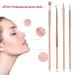 4PCS Acne Remover Tool Set - Stainless Steel Rose Gold Blackhead Extractor for Blemishes Whiteheads & Pimples - Buy Online on GoSupps.com