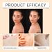 Huile De Busserole Eclaircissante Huile Visage Et Corps Huil Eclaircissante Peau Noire Soin claircissant Anti-Taches Unifie Le Teint & Illumine La Peau Hydratation & clat Naturel 100 Ml - Buy Online on GoSupps.com