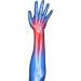 Buy Soles Wrist Splint Brace - Adjustable Comfortable Support for Pain Relief | International Shipping Available - Buy Online on GoSupps.com