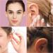 Buy Silicone Ear Correction Stickers - 30 Self-Adhesive Solutions for Protruding Ears | Cosmetic Ear Corrector for Large Ears - Buy Online on GoSupps.com