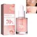 KOAHDE 70% Niacinamide Serum Anti-Aging Face Serum with Peach Extract Brightening Hydrating Face Glow Serum Face Moisturiser Anti-Aging Face Serum Peach Essence 70% Niacinamide Serum 30ML