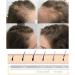 Hair Growth Wand Haute frequence baguette pour la croissance des cheveux Baguette de croissance des cheveux avec hair serum Baguette de croissance des cheveux avec 4 tubes diff rents (1 Blanc) 1 Blanc - Buy Online on GoSupps.com