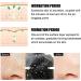 10 Pcs Benzoyl Peroxide Blackhead Remover Nose Strips for Face and Pores - Buy Online on GoSupps.com