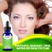 Tea Tree Serum Oil for Acne - 20% Vitamin C Hyaluronic Acid Retinol | Anti-Aging Dark Spots & Blemish Treatment | 2 Fl Oz (60 ml - Buy Online on GoSupps.com