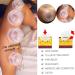6 Sizes Silicone Cupping Therapy Set - Strong Suction for Myofascial Massage, Pain Relief - Professional Studio and Household Cupping Kit - Buy Online on GoSupps.com