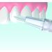 Miradent Mirawhite Shine Bleaching Gel 1.8 ml - Gentle Peroxide-Free Whitening for Bright White Teeth | Hygienic Formula with Active Oxygen - Buy Online on GoSupps.com