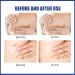 Silicone Breast Scar Sheets for Scar Reduction and Elasticity Restoration - Buy Online on GoSupps.com
