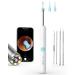 Xlife Ear Wax Removal Wireless Ear Camera with1080P HD Earwax Remover & 4 Pack Blackhead Remover Kit Ear Cleaner with 3.5mm Ultra-Thin Lens for iPhone iPad & Android Phones (R1 White)
