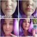 Lips Plumping Tool Lip Plumping Silicone Tool Women Portable Fish Shaped Lips Plumper Enhancer Lip Enhancement Device Beauty Tool - Buy Online on GoSupps.com