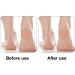 Callus Remover Feet Scrubber Exfoliation Foot Stone Foot Pumice Stones Dual Sided Foots Exfoliator Scrubber Ideal for Removing Calluses and Promoting Healthy Feet Random Color - Buy Online on GoSupps.com