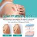 Advanced Scar Spray for Acne, Surgical Scars & Stretch Marks - Gentle Skin Care Treatment for Dark Spots - All Types of Scars Remover - Buy Online on GoSupps.com