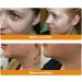 ZVLZVL Bee Venom Treatment Cream - Moisturizer & Skin Repair for Men & Women (30ml) | Buy Internationally - Buy Online on GoSupps.com