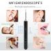 Wireless Ear Otoscope 1080P FHD Earwax Cleaner - Safe & Easy Ear Wax Removal Tool for Kids, Adults, Pets - Buy Online on GoSupps.com
