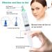 23Pcs Q-Grips Spiral Ear Wax Removal Tool Kit - Earwax Remover, Syringe, Silicone Cleaner, Bamboo Pick - Ear Irrigation Cleaning Set - Buy Online on GoSupps.com