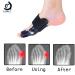 Cubaco Articulated Bunion Corrector & Separator - Black | Relieve Pain & Improve Alignment - Buy Online on GoSupps.com