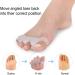 Orthopedic Toe Separators and Stretchers - Gel Silicone Spacers for Toe Alignment and Pain Relief - Bunion Corrector and Hammer Toe Straightener - 2 Pairs for Women and Men - Buy Online on GoSupps.com
