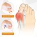 Gel Big Toe Bunion Guard Kit - Men and Women Bunion Corrector & Straightener for Hammer Toe. Ideal for Running & Sleeping - Day/Night Treatment - Buy Online on GoSupps.com