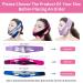 BIUBIU TOWNLET Double Chin Reducer Face Slim Strap - Reusable Anti-Wrinkle Face-Lifting Artifact for Firmer Skin (Normal-Plus) - Buy Online on GoSupps.com