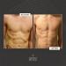 FasciaBlaster Muscles Kit by Ashley Black - Cellulite and Fascia Massagers with Cold Pack and Topicals for Athletes - Buy Online on GoSupps.com