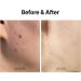 MEDITHERAPY A Clearing Toner Swab - Vegan Soft Exfoliator for Acne-Prone Skin Pore Tightening Korean Skincare - Buy Online on GoSupps.com