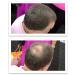 Caboki All-Natural Hair Building Fiber | Hair Loss Concealer for Bald Spots and Thinning Hair (Medium Brown) - 40-Day Supply - Buy Online on GoSupps.com