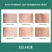 DAUERHAFT Scar Care Cream - Reduce Wrinkles, Surgery Scars, Irritation-Free - Women's Scar Removal Cream - Buy Online on GoSupps.com