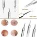 Usiveinborn Blackhead Remover Usiveinborn Tweezers Teppeic Tweezers Usiveinbor Pimple Popper Tool Kit Stainless Steel Professional Facial Blackhead Remover Tweezers 125 Elbow Design (7PCS) - Buy Online on GoSupps.com
