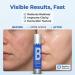 Perfect B3 Niacinamide Spray - Topical Mist with Hyaluronic Acid Glycerin Vitamin B3 and Aloe for Skin Clarity Texture & Hydration - Gentle Niacinamide Serum Alternative - 3.6 fl oz - Buy Online on GoSupps.com