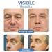Openeyes Rejuvenating Eye Lifting Gel for Men & Women - Awakening Peptide Tightening Eye Gel 75g - Buy Online on GoSupps.com