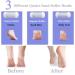 OUXI Electric Foot Callus Remover - Rechargeable 16-in-1 Pedicure Kit with 3 Roller Heads, Waterproof Dead Skin Foot File - 2 Speeds, Pedicure Tools for Men and Women - Buy Online on GoSupps.com