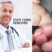 Corn Removal Pads - 24pcs Corn Remover Treatment for Painful Corns and Calluses - Buy Online on GoSupps.com