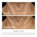Epionce Intensive Nourishing Cream - Anti-Aging Moisturizer for Face, Neck & Decolletage, For All Skin Types with Ceramides, Glycerin & Squalene, Dermatologist Skincare - Buy Online on GoSupps.com