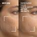 Dr. Brandt Microdermabrasion Renewing Face Exfoliator - Best Exfoliating Scrub for Dull Skin Fine Lines & Acne Scars - 2 oz International Shipping - Buy Online on GoSupps.com