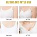 FIONEL Chest Enhancement Patch - Natural Breast Firming & Nourishing Patches for Women - 30pcs - Buy Online on GoSupps.com