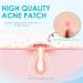 Pimple Patches Hydrocolloid Spot Remover Patches Spot Treatment Pimple Stickers Breakout Acne Patch Anti Acne Dots Made With Natural Oils Tea Tree and Calendula For Fast Acting Skincare - Buy Online on GoSupps.com