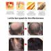 MKKENLEY Magic Hair Growth Tonic with Ginseng for Fast Hair Growth | Best Treatment for Men and Women with Baldness | Nourishing Scalp and Anti-Hair Loss Formula for Hair Regrowth - Buy Online on GoSupps.com