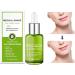 Goopgen Advanced Scar Repair Serum - Nature Scar Treatment for Acne, Surgical Scars, and Stretch Marks (1pcs) - Buy Online on GoSupps.com