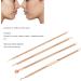 Qukaim Blackhead Removal Tool Pimple Blackhead Remover Tool Kit 4 Set Stainless Steel Comedone Extractor for Professional Zit Whitehead Popper - Buy Online on GoSupps.com