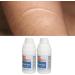 Deep Hydration Pregnancy Stretch Mark Cream Reduce Scars Promote Healing Nourishing Gel 2pcs Suitable for Various Scars Organic Material - Buy Online on GoSupps.com
