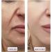 Lifting-Sil E-ssence Cr me raffermissante pour le visage gel hydratant pour le visage am liore l'hyperpigmentation contre le vieillissement cutan  - Buy Online on GoSupps.com