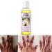 Peeling Oil Extra Strong Peeling Oil Yellow Peeling Oil for Dark Skin Exfoliating Peeling Solution for Body Hand Feet and Face All Skin Type (110ML/3.88 Fl Oz)
