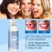 Surakey Tooth Repair Granulate - Temporary Tooth Filling Set for Missing & Broken Teeth (3 Pieces) - Fast & Effective Repair Solution - Buy Online on GoSupps.com