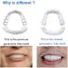 4-Piece Snap-In Veneers - Comfort Fit Fake Teeth for Perfect Smile | Beautiful Dentures for Broken Teeth - Buy Online on GoSupps.com