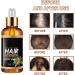 30ml Ginger Hair Growth Serum Hair Growth Treatment Oil for Men Women Anti Hair Loss Thinning Promote Hair Regrowth - Buy Online on GoSupps.com