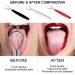 Stainless Steel Tongue Scraper Kit | Metal Tongue Cleaner for Adults | Combat Bad Breath | Oral Care Essentials in Silver Red Black - Buy Online on GoSupps.com
