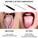 3 Pack Stainless Steel Tongue Scraper with Case - Dual Scraping Metal Tongue Cleaner for Adults - Fight Bad Breath - Oral Care Kit (Black Red Silver) - Buy Online on GoSupps.com