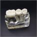 4x Enlarged Teeth Model for Dental Education | Implant & Crown Simulation | Ideal for Teaching & Demonstration - Buy Online on GoSupps.com