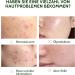 Anti-Acne Serum for the Face - Plumping and Radiant Skin Face Serum Reduces Fine Lines & Wrinkles - Buy Online on GoSupps.com