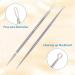 Professional Blackhead and Whitehead Extractor Tool Kit - 5 Pcs/Set for Face and Nose - Stainless Steel Pimple Popper Set VT921A - Buy Online on GoSupps.com