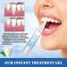 4ML Gum Shield Therapy Gel 2024 New Receding Gums treatments Instant Soothing Gel Gum Shield Therapy Gel for Deep Cleaning Stains and Tartar Oral Care#4ml - Buy Online on GoSupps.com